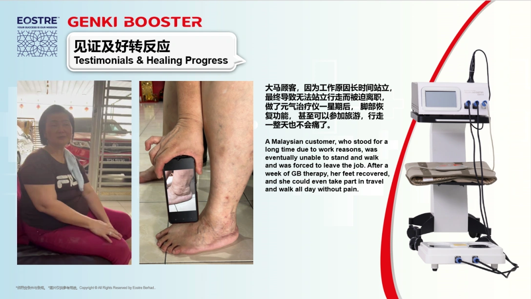 腿部活动受限